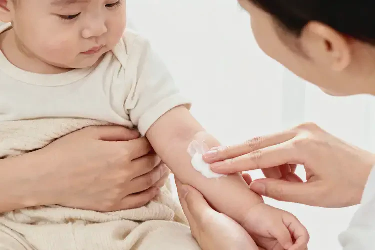 嬰兒四肢出濕疹不管它會(huì)自己痊愈嗎(圖1)