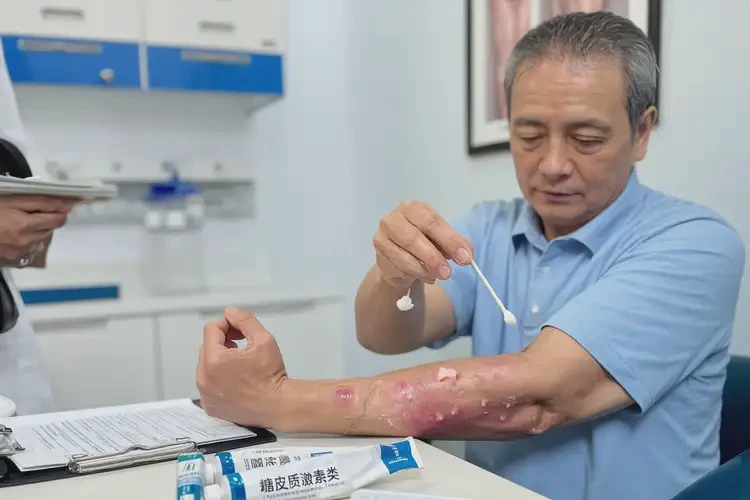 高齡老人屁股上容易起濕疹可以徹底自愈嗎(圖1)