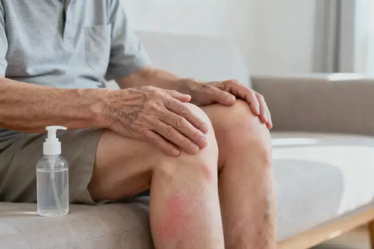 老人大腿出濕疹不管它會(huì)自己好嗎(圖2)