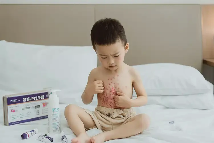 孩子肚子經(jīng)常起濕疹不管它會(huì)自己好嗎(圖4)