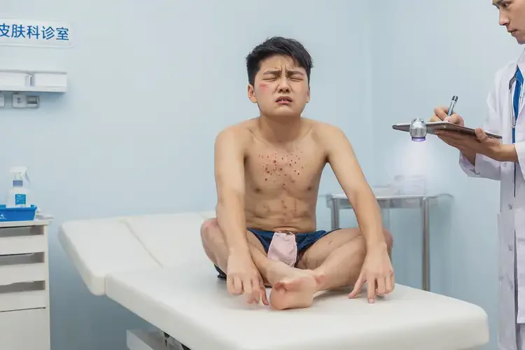 青少年肛周起湿疹不管它会自己自愈吗(图4)