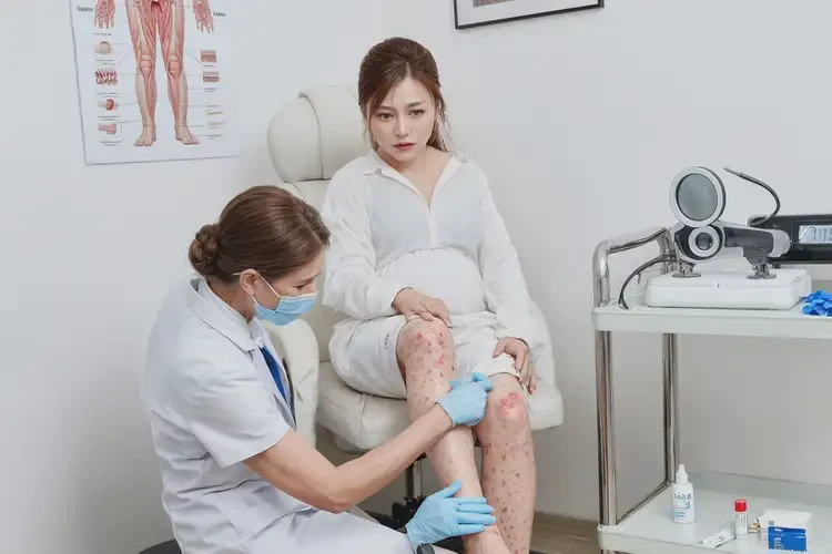 產(chǎn)婦小腿容易起濕疹不管它會(huì)自己痊愈嗎(圖1)