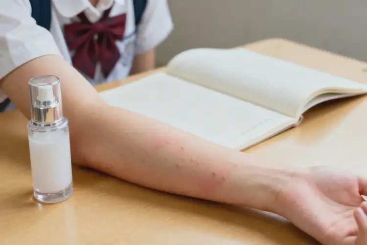 大學生手臂上經常起濕疹能夠徹底治愈嗎(圖1)