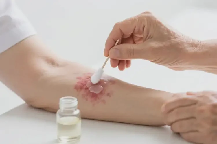 老人手臂经常起湿疹不管它会自己好吗(图2)