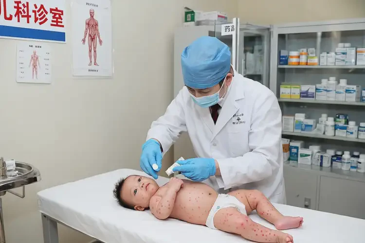 寶寶全身有濕疹能靠自己自愈嗎(圖3)