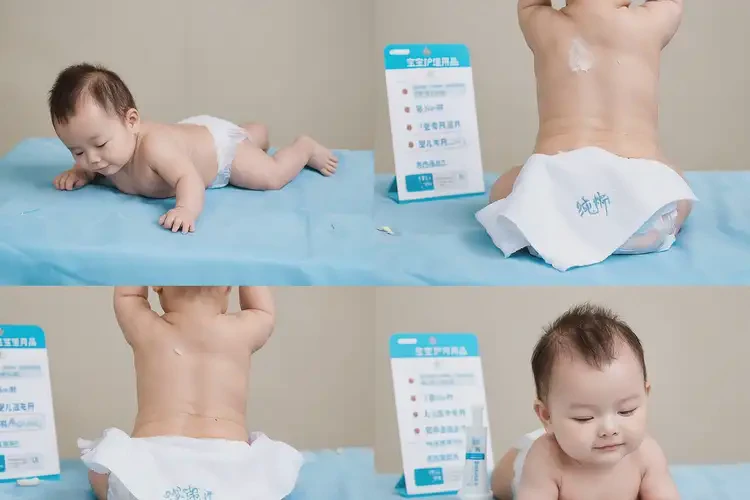 寶寶肛周經(jīng)常長濕疹可以徹底自愈嗎(圖3)