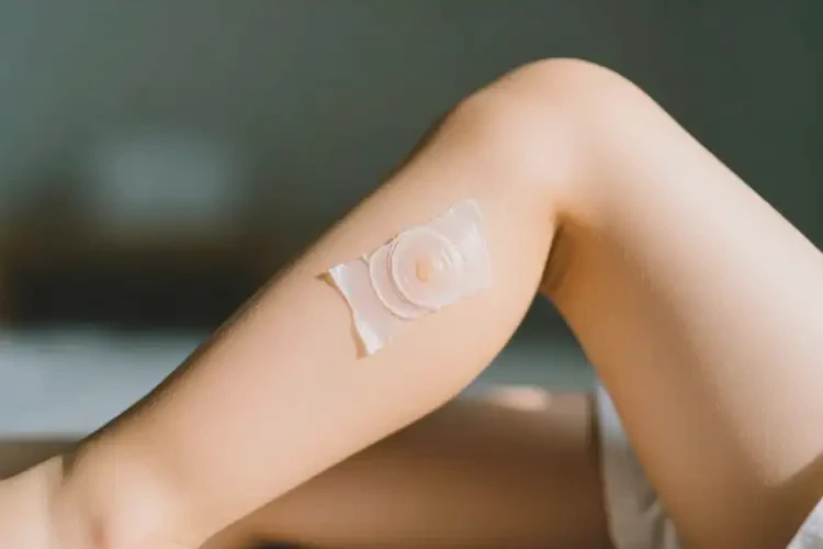 孩子大腿上起濕疹能夠徹底治愈嗎(圖2)