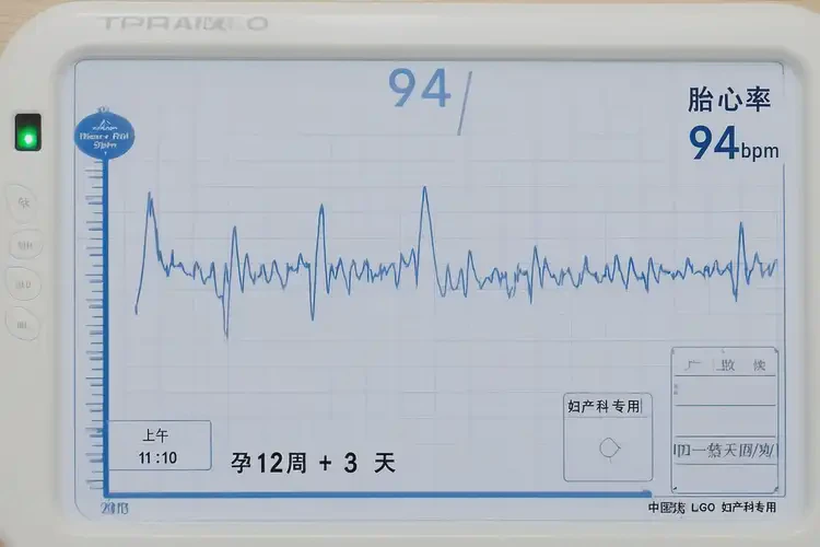 孕6周1天胎心率94怎么回事(圖4)