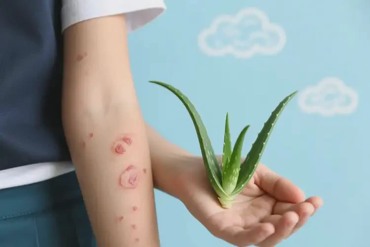 中學(xué)生手臂出濕疹能徹底自愈嗎(圖1)