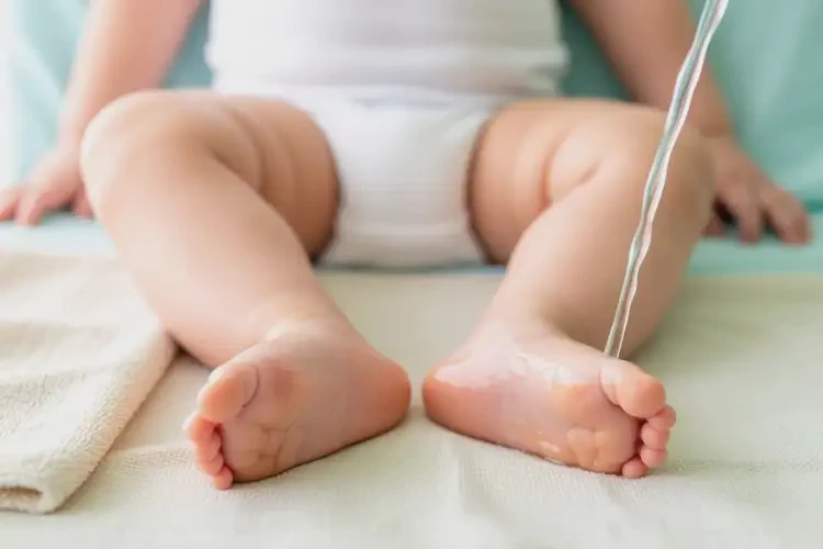 嬰幼兒腳上容易起濕疹能夠徹底治愈嗎(圖2)
