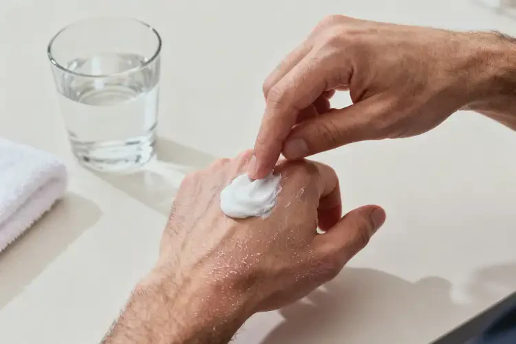 男性手上長濕疹能夠徹底治愈嗎(圖1)