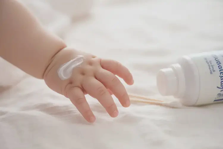 嬰幼兒手上容易起濕疹可不可以徹底自愈(圖3)