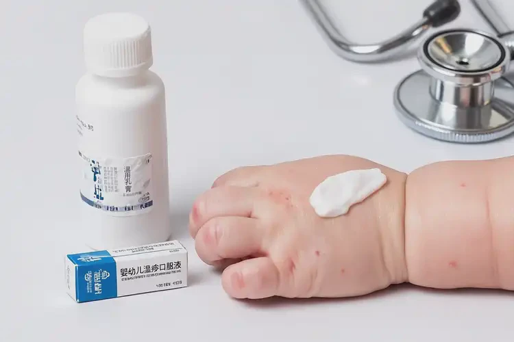 嬰幼兒手上容易起濕疹可不可以徹底自愈(圖2)