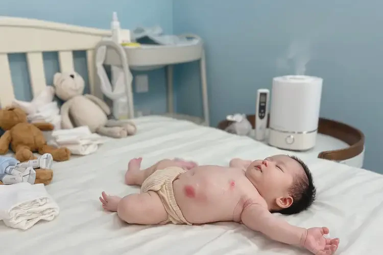 孩子肚子容易起濕疹能徹底自愈嗎(圖3)