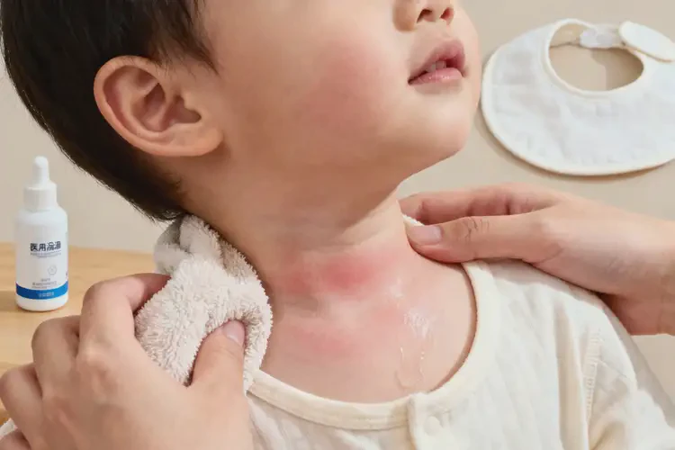 幼兒脖子上經常起濕疹不管它會自己痊愈嗎(圖3)