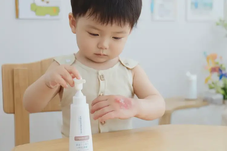 幼儿手上经常长湿疹不管它会自己痊愈吗(图2)