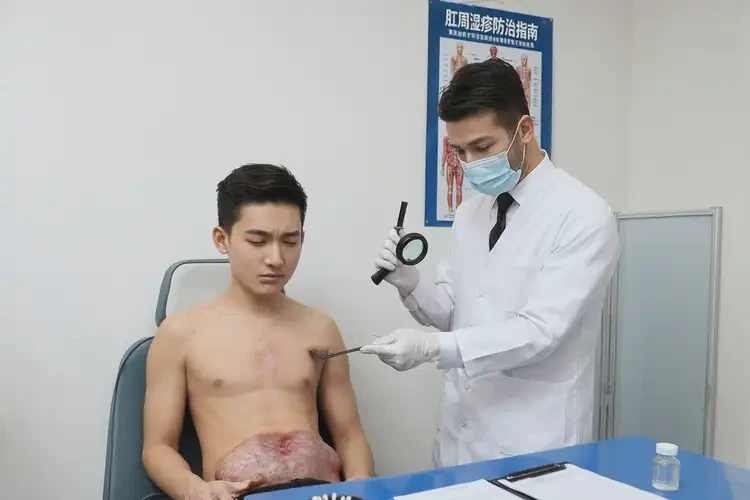 青年人肛周經(jīng)常長濕疹可以徹底自愈嗎(圖2)