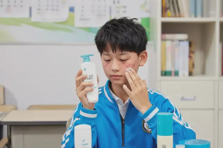 中学生面部有湿疹可以彻底自愈吗(图2)
