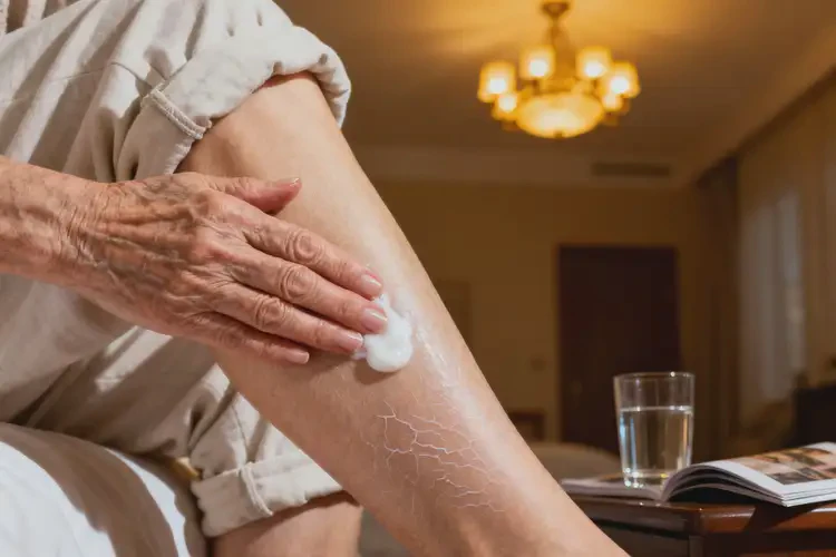 老年人小腿上偶爾長濕疹可以徹底自愈嗎(圖3)