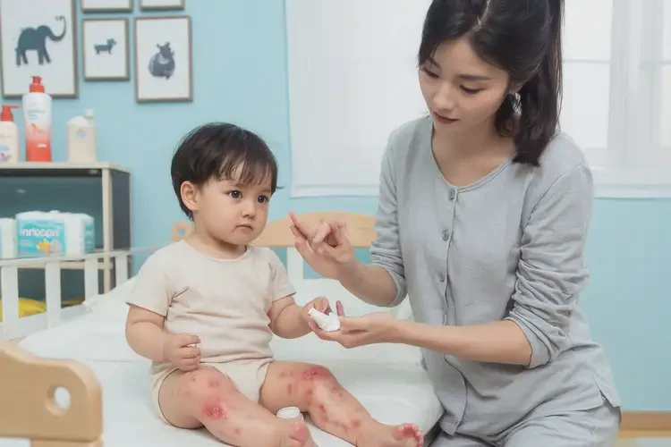 幼儿身上起湿疹能够彻底治愈吗(图2)