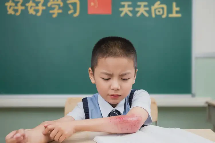 小學(xué)生大腿起濕疹不管它會(huì)自己痊愈嗎(圖4)