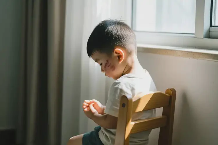 小孩臉上出現(xiàn)濕疹不管它會(huì)自己好嗎(圖2)