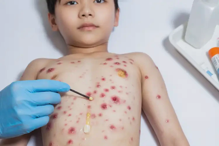 男人肚子上偶爾長(zhǎng)濕疹能徹底自愈嗎(圖2)