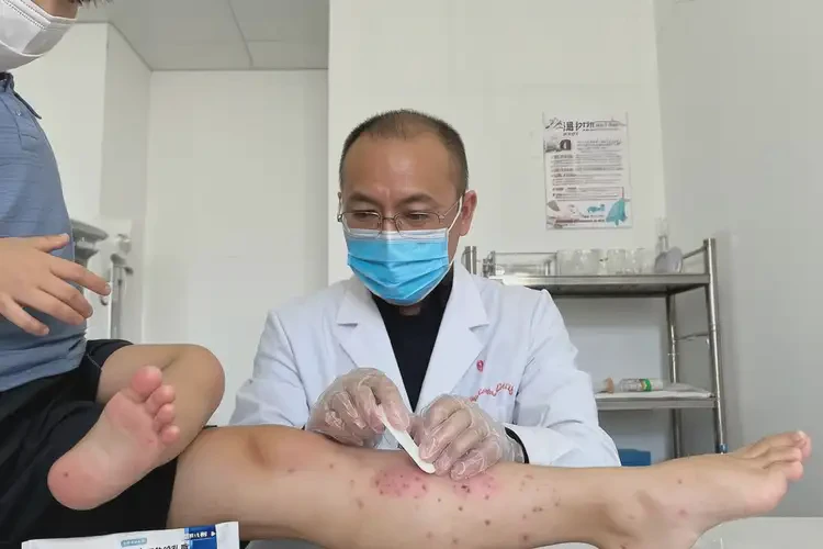 孩子小腿上容易長濕疹不管它會自己痊愈嗎(圖3)