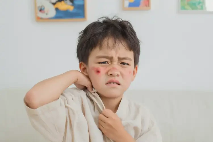 小兒面部長濕疹能徹底自愈嗎(圖2)