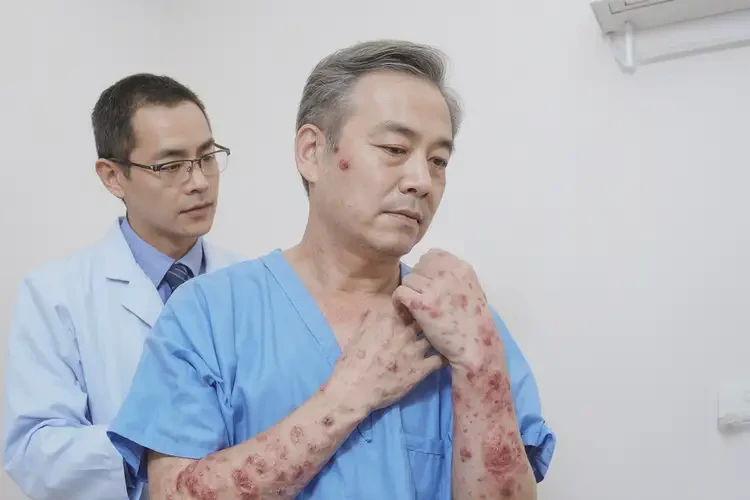 青年人面部出現(xiàn)濕疹能徹底自愈嗎(圖2)