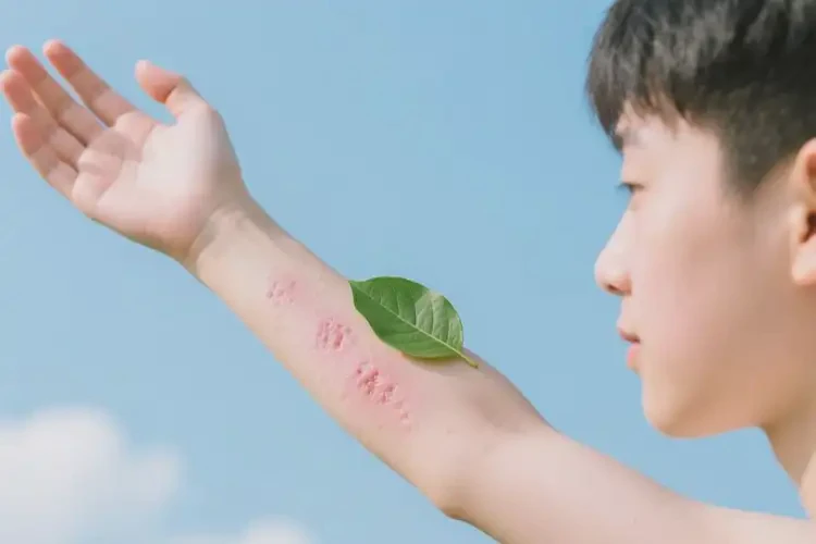 青少年四肢出現(xiàn)濕疹可以徹底自愈嗎(圖1)