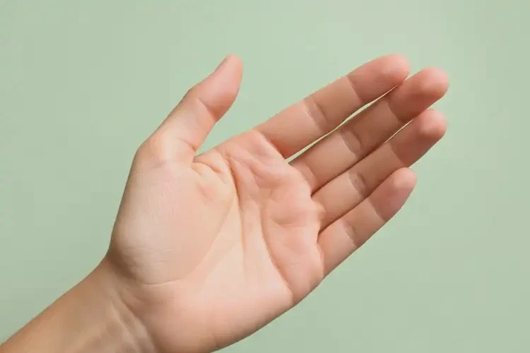 女性手上有濕疹能徹底自愈嗎(圖1)