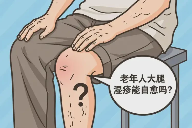 老年人大腿出濕疹不管它會自己自愈嗎(圖3)