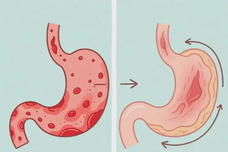 青少年肚子上長(zhǎng)濕疹能夠徹底治愈嗎(圖3)