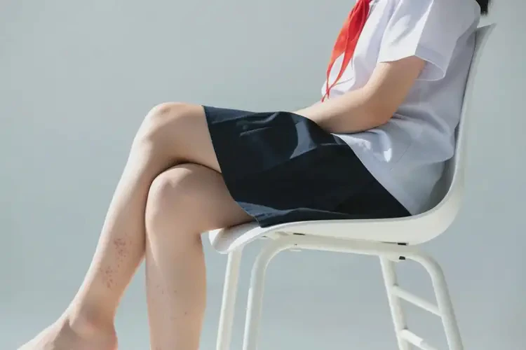 中學(xué)生小腿偶爾起濕疹可不可以徹底自愈(圖3)