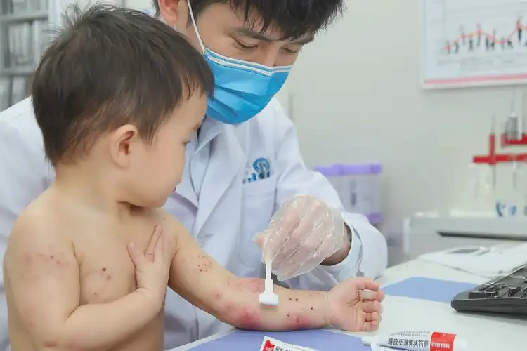 寶寶手臂有濕疹不管它會(huì)自己自愈嗎(圖3)