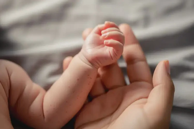 新生兒身上偶爾起濕疹能徹底自愈嗎(圖3)