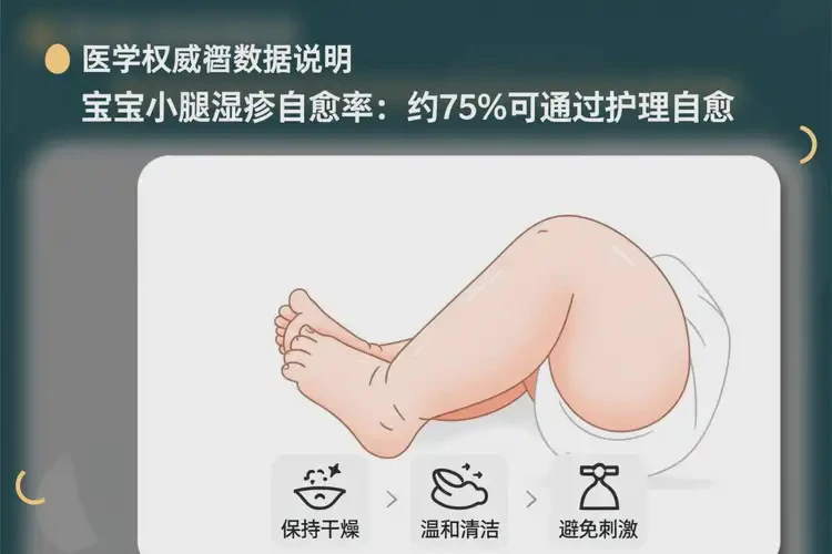寶寶小腿上經(jīng)常起濕疹能徹底自愈嗎(圖3)