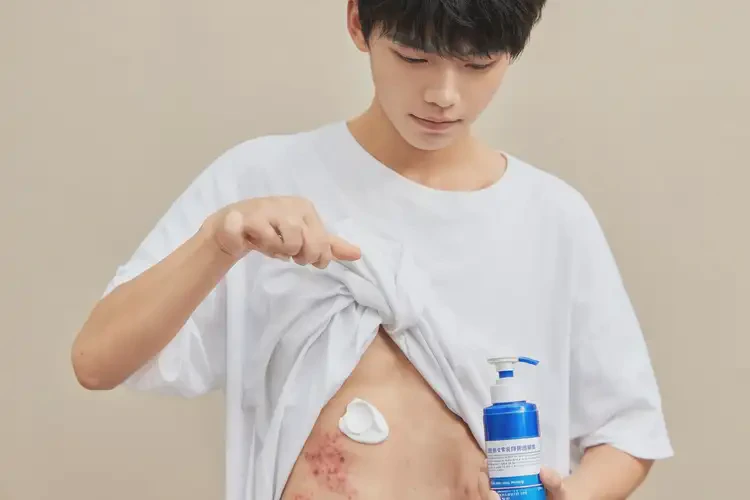 男生肚子出濕疹能靠自己自愈嗎(圖2)