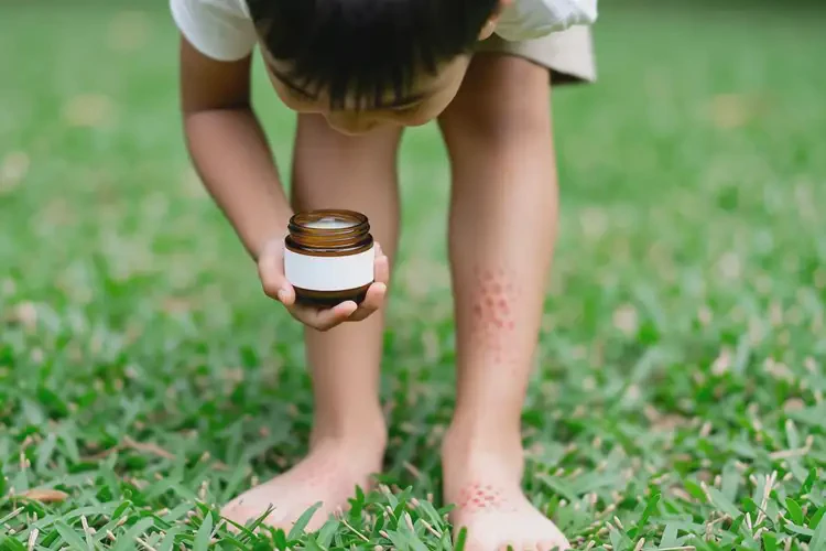 青年人腳上長濕疹能徹底自愈嗎(圖1)