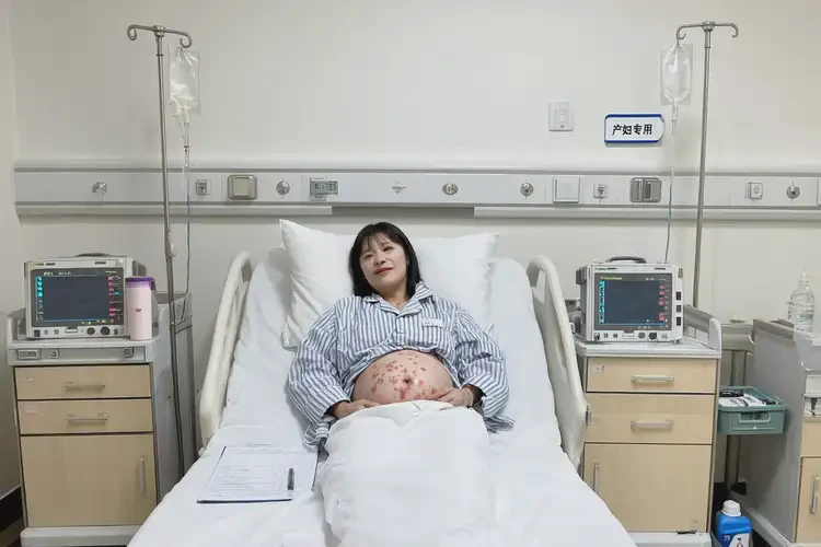 產(chǎn)婦大腿偶爾起濕疹不管它會(huì)自己自愈嗎(圖2)