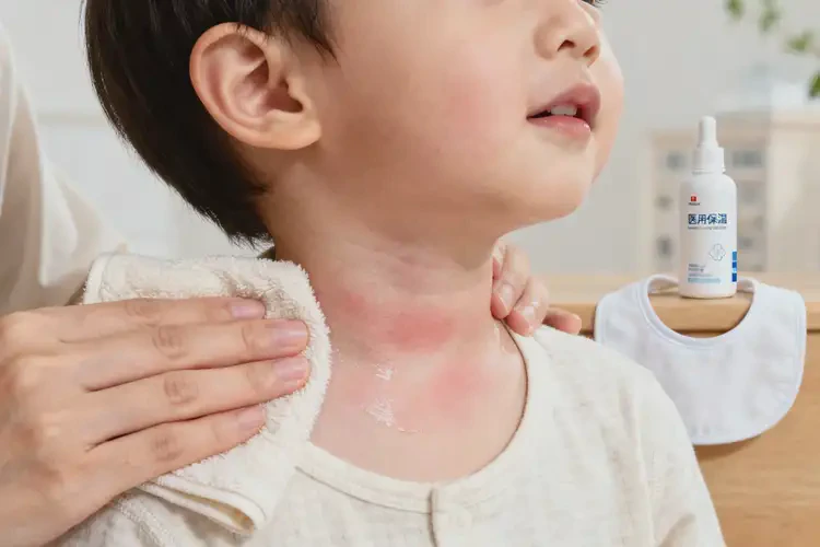 幼兒脖子上經常起濕疹不管它會自己痊愈嗎(圖1)