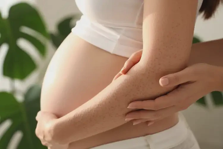 產(chǎn)婦手臂容易起濕疹可以徹底自愈嗎(圖2)