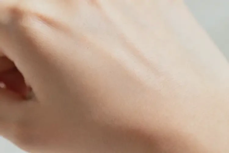 女生屁股上出濕疹不管它會(huì)自己好嗎(圖1)