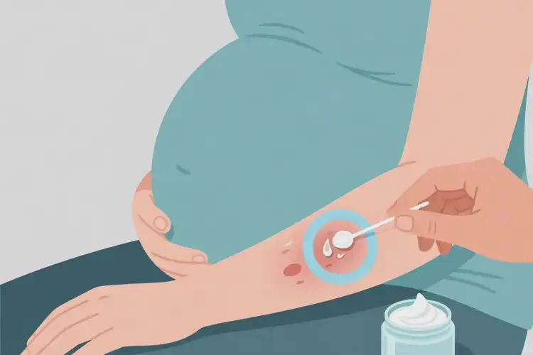 孕婦手臂上出濕疹可不可以徹底自愈(圖3)