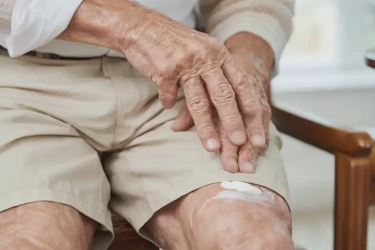 老年人大腿有濕疹能徹底自愈嗎(圖2)