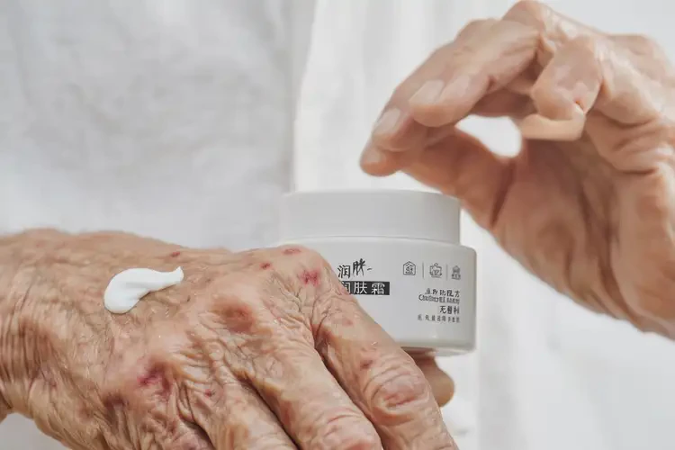 高齡老人全身有濕疹能不能徹底自愈(圖4)