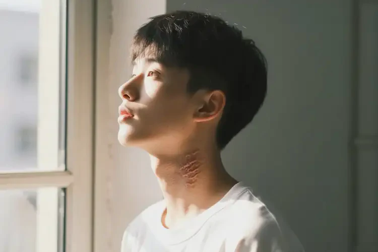 大学生脖子上出湿疹能够彻底治愈吗(图1)