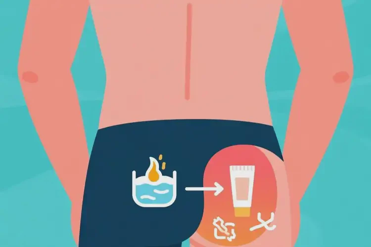 男生肛周容易起濕疹能夠徹底治愈嗎(圖1)