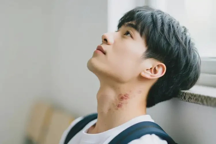 大学生脖子上出湿疹能够彻底治愈吗(图4)